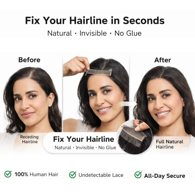 💝Instantly Fix Your Hairline — No One Will Ever Know💝