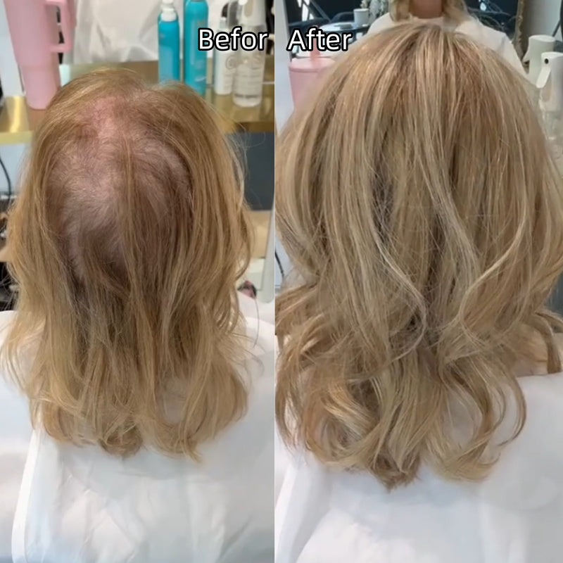 💎 Final Hours –💝2026 New Lightweight & Breathable Wavy Hair Topper